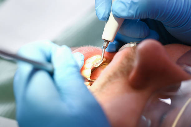 Best Emergency Cosmetic Dentistry in Tuckahoe, VA